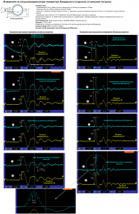 KK_Exps.png
